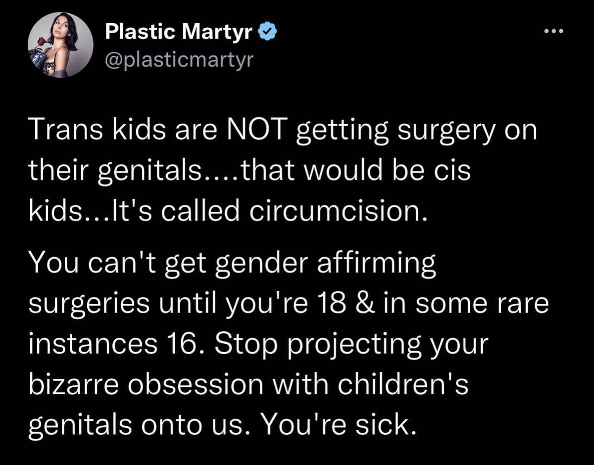 RyanShead's tweet photo. Wow, I’ve upset the circumcision crowd tonight…yikes. 😂

To be clear: I am circumcised and so is my son. 🤷🏻‍♂️

It’s hard to understand how so many fail to see comparisons between the dangerous talking point that the transgender community is mutilating children versus how many circumcisions are happening each hour in America.

Be more pissed off about how the trans community is being discriminated against than me hurting your feelings. 

#TransRightsAreHumanRights