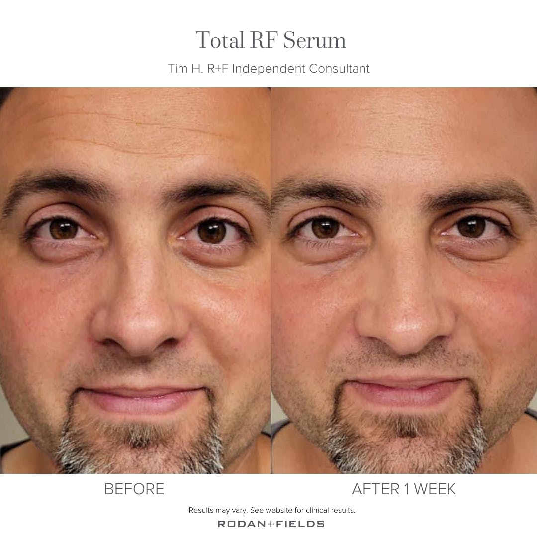 bex0470's tweet photo. Men need good skincare too! https://t.co/EPiZmHQ32t https://t.co/EgvKhStRrA