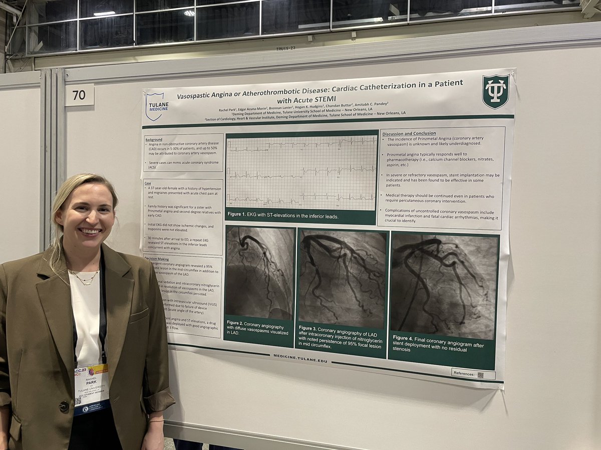 AmitabhCPandey's tweet photo. Amazing case by our standout #IM #residents @Tulane @TulaneMedicine  showing a case from their time on #CCU about vasospasm &amp; #STEMI. @BrennanLanier @edgaream #Cardiotwitter https://t.co/CBYcHnvpL6