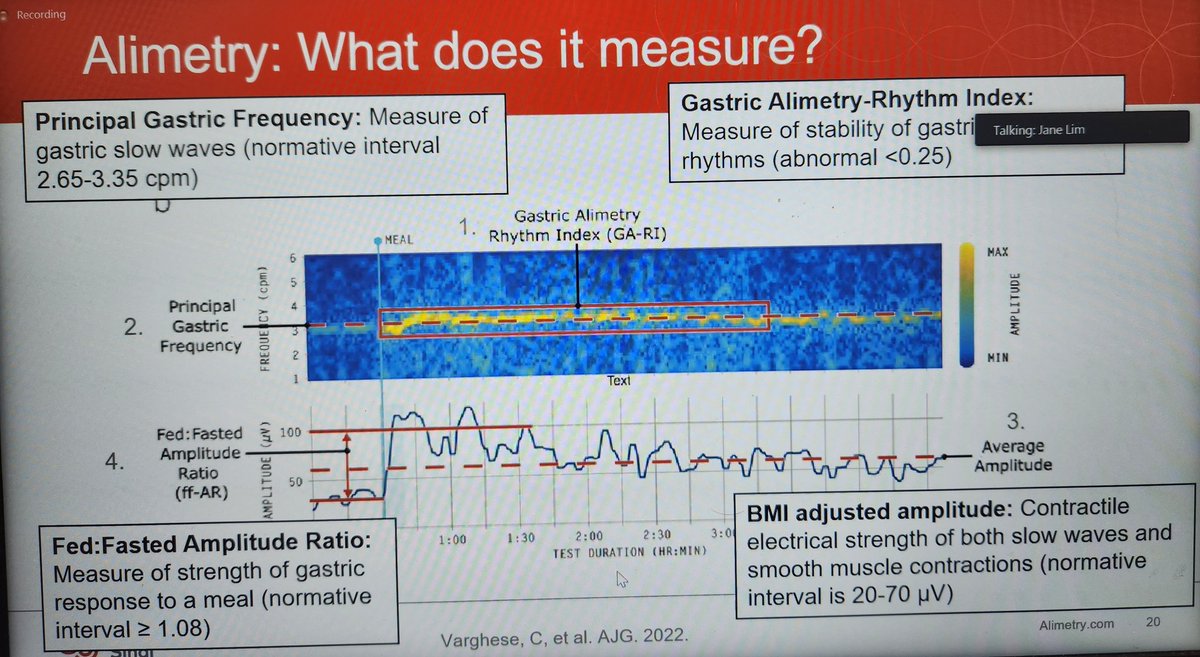 Dr. Jane Lim discussing the intricate details of gastric body surface mapping. A physiology-based test that will change management of foregut motility disorders.
