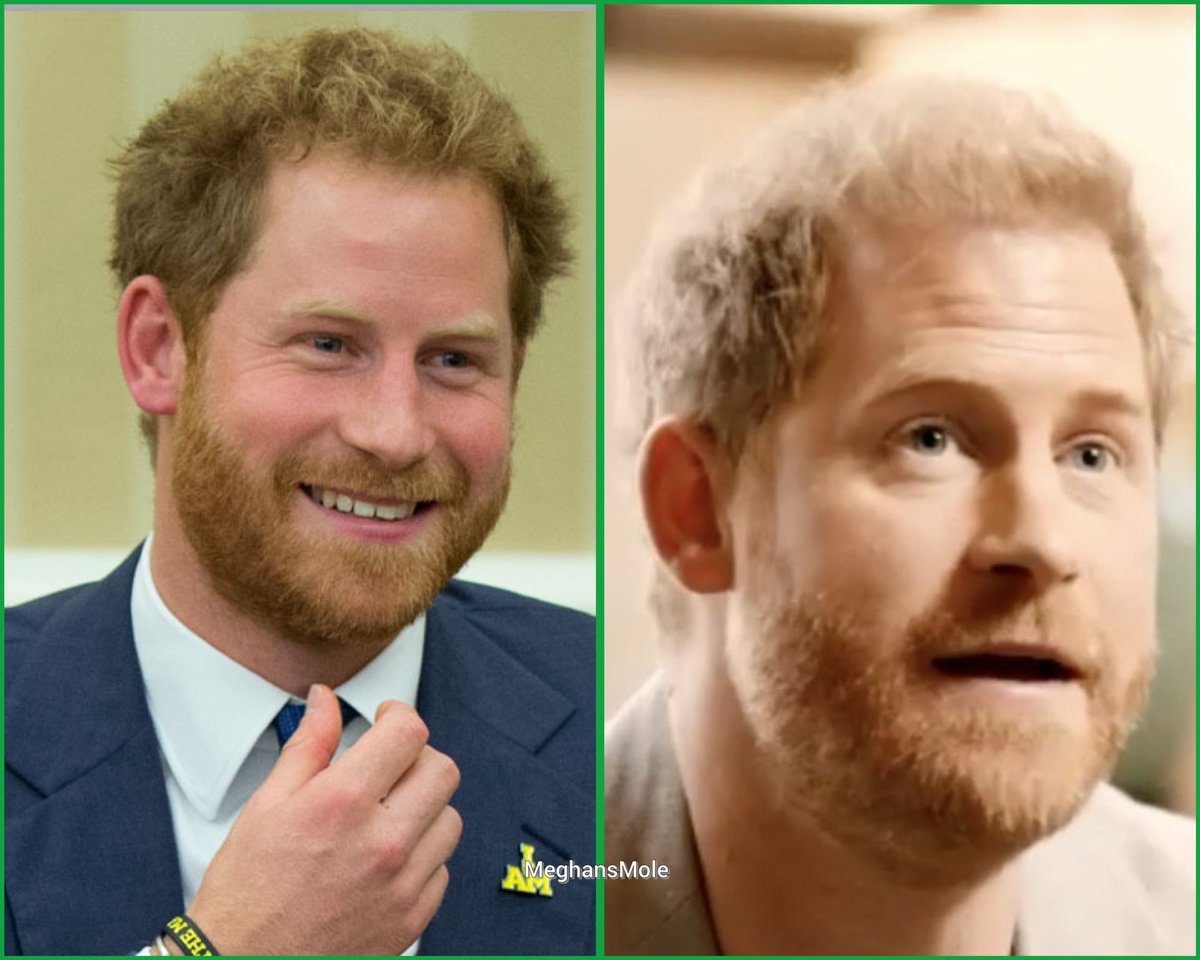 MeghansMole's tweet photo. Harry, 2015 before Meghan 

VS 

Harry, 2023 with Meghan 

Proof that choosing the right woman matters https://t.co/KW1MEDK2La