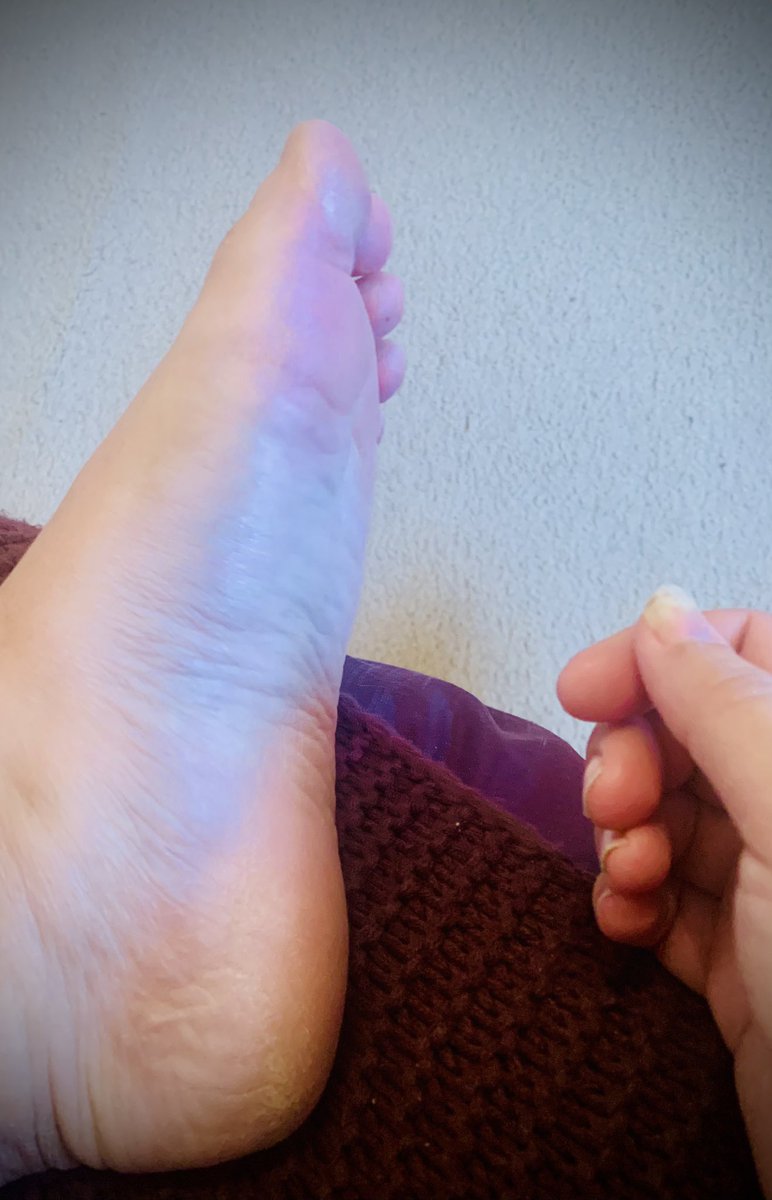 finefootography's tweet photo. Hand &amp; Soles #feetpic #feetpicsforsales #prettyfeet https://t.co/wWparV9Aze