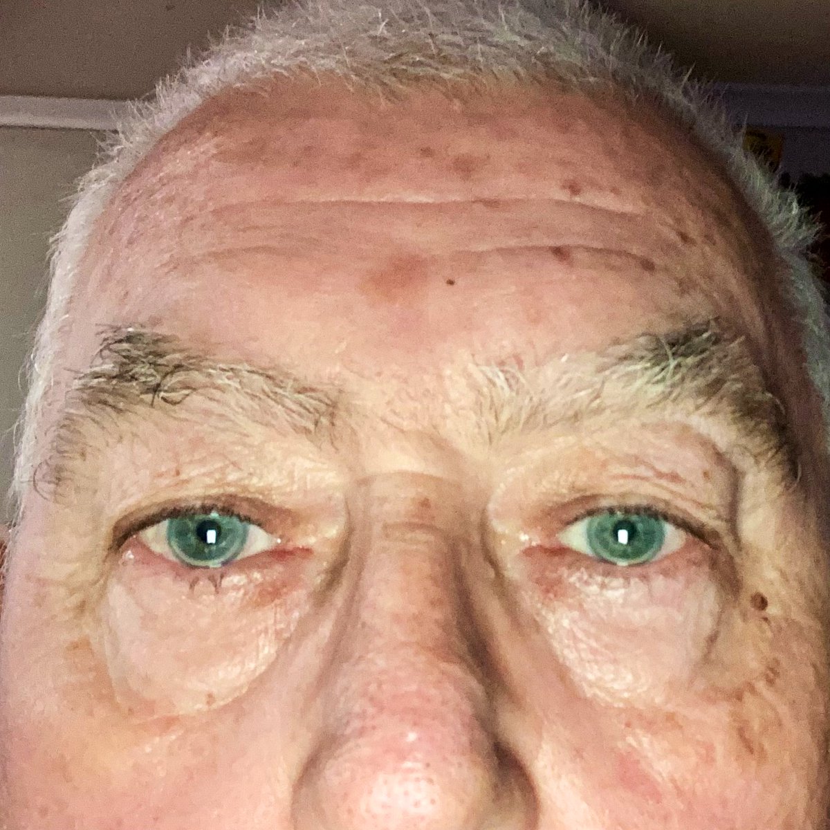 💙💛Bill ♿️🧑🏻‍🦽🏀🦻💉💉💉💉💙💛 tweet media