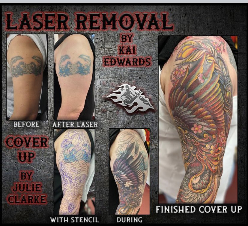 A successful laser tattoo removal to cover up! 🎉🌟🎉
#Colchester #colchestertattoo #tattoo #coveruptattoo #lasertattooremoval #ArtistOnTwitter #SundayMotivation
