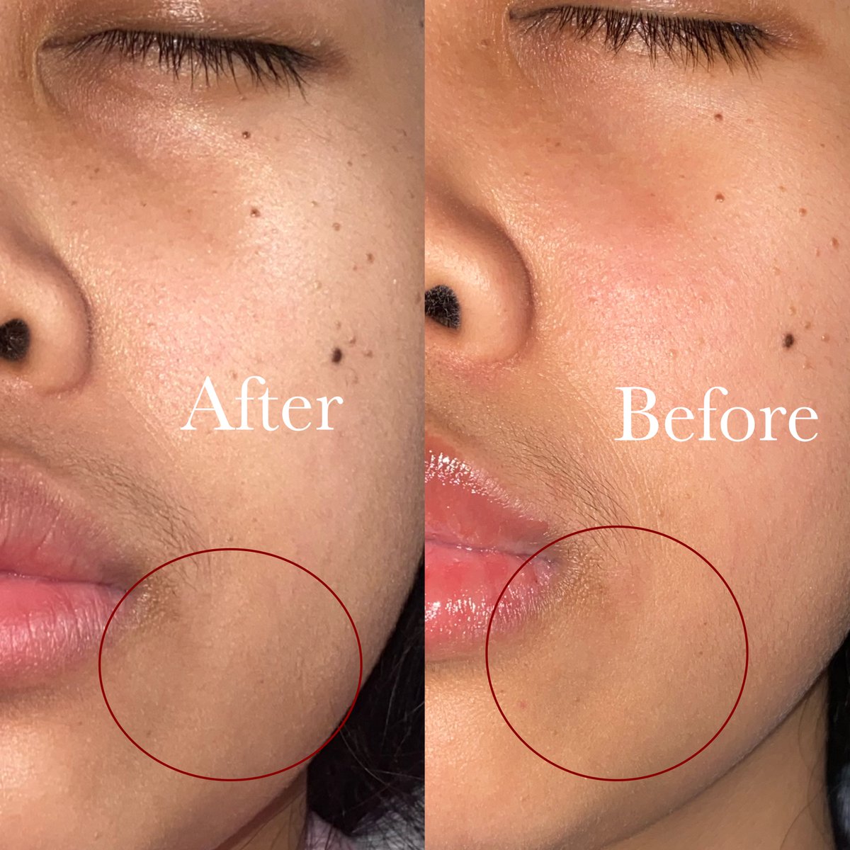 beautiaf's tweet image. cuaca yang lg gak nentu bikin kulit aku yang dry skin gampang kering sampe mengelupas :(

makanya moisturizer itu penting dan urgent banget buat kulitku yang sering rewel ini, untuk ngehidrasi luar dalam.