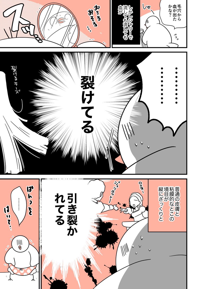 自分の股間が裂けた話をわざわざ漫画にするような人間がいるわけないじゃないですか!🕊
 #作家は経験したことしか書けない 

脱毛しようとして股間が裂けた話①/2 