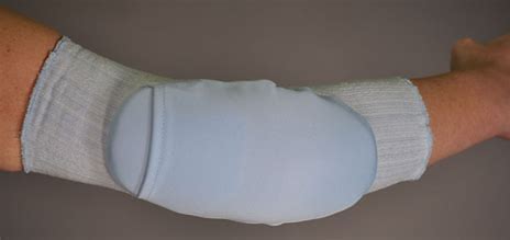 📢New report; splinting is effective in treating cubital tunnel (note, outcome measurement was variable). I'm splinting with an elbow flotation pad with thermoplastic insert, rotated to block flexion. Well tolerated for night wear. What are your top tips? 
pubmed.ncbi.nlm.nih.gov/36755648/