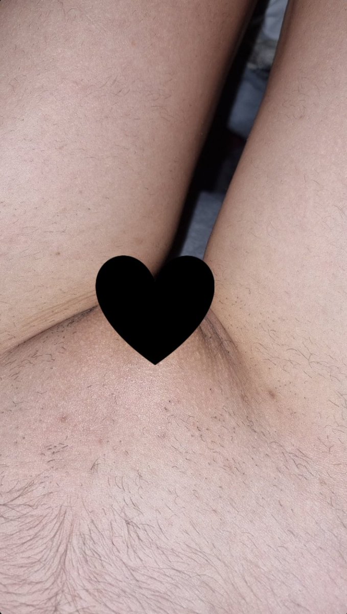 juuul7a's tweet photo. Like + Rt pour une nude gratuite.
Like + Rt for a free nude. https://t.co/sndDuJj2iP