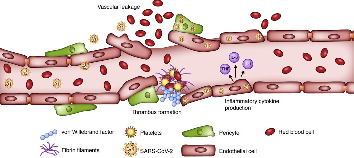 EricTopol's tweet photo. We've known that Covid can predispose towards clots. But what about late effects, months after an infection? A summary of the evidence that has been recently updated
https://t.co/6iqDJ3oV1b https://t.co/RsoxU166Yr