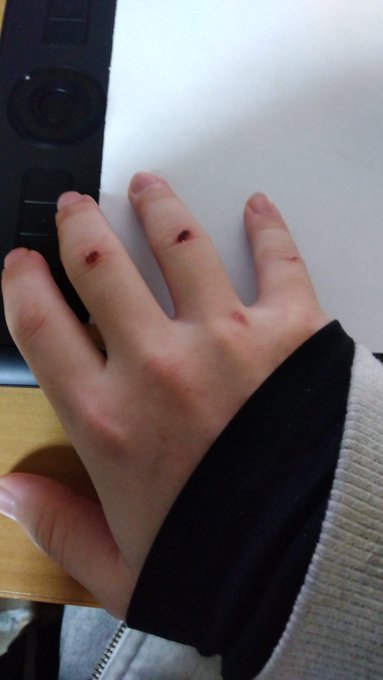 なんかまた寝てる間に指削れてホコリまみれなっとんやけど 