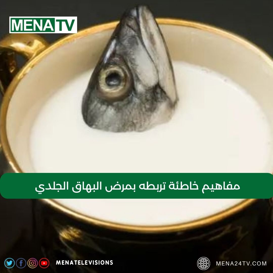 Arab_24News's tweet photo. مفاهيم خاطئة تربطه بمرض البهاق الجلدي
https://t.co/67QY4Wzoht 

#Menatv https://t.co/dP1Hc6G4NF