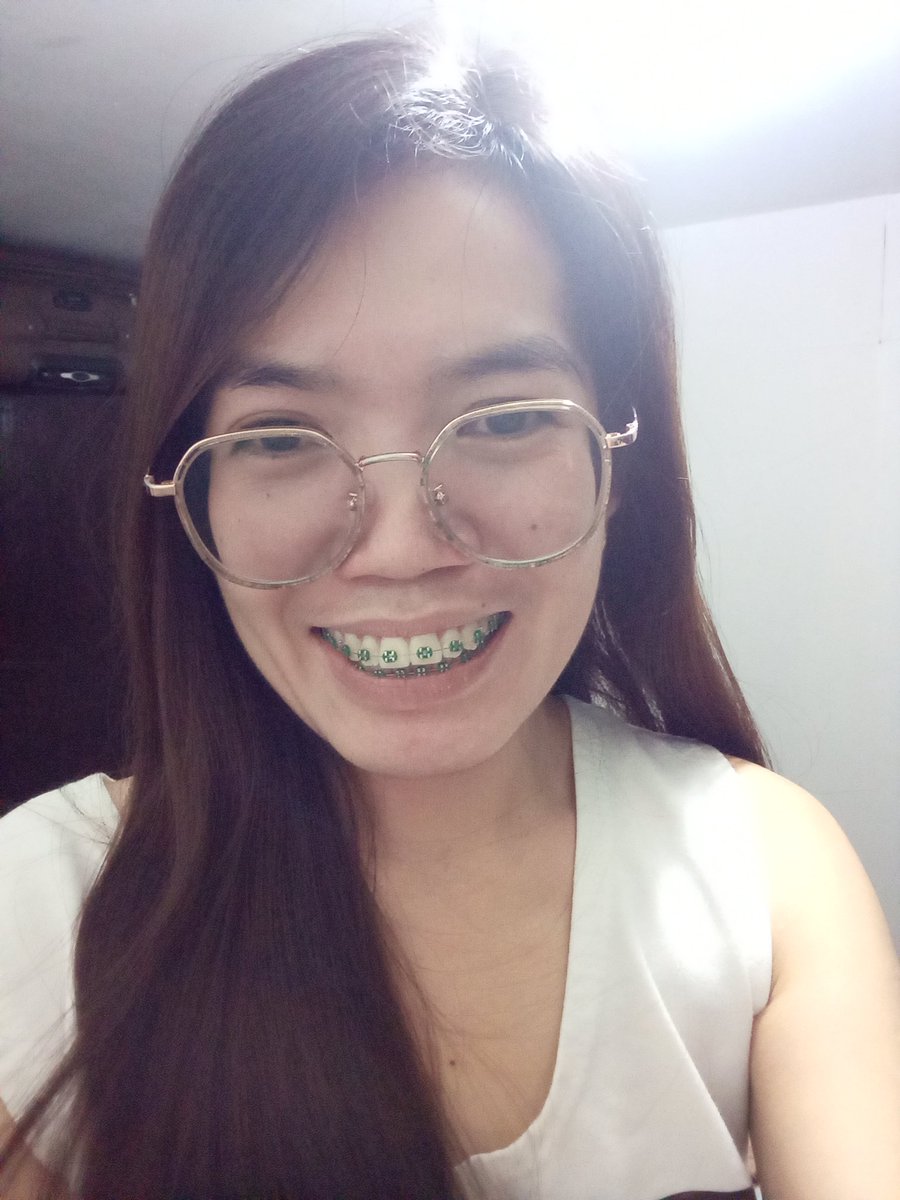 Rolieme22's tweet image. 85th day of braces 😁

#overbite