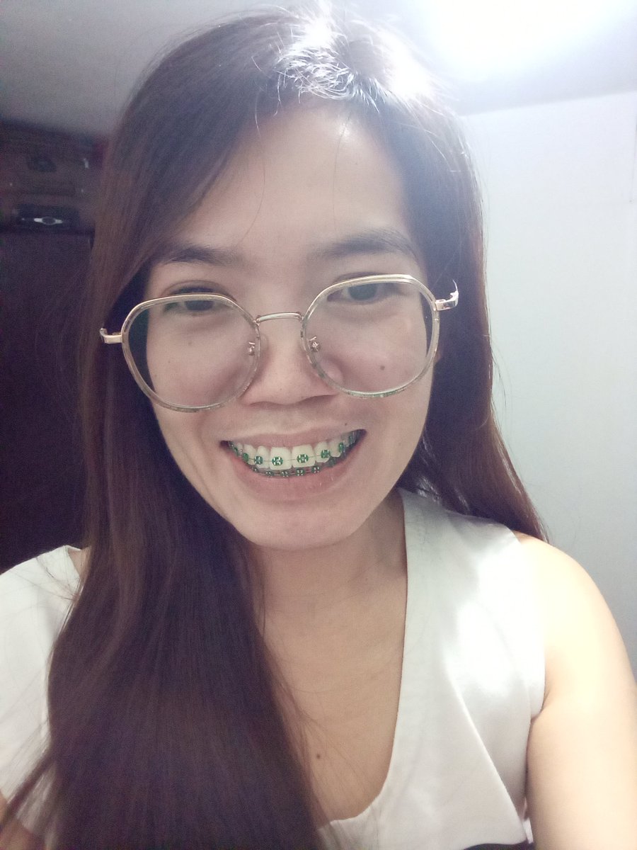 Rolieme22's tweet image. 85th day of braces 😁

#overbite