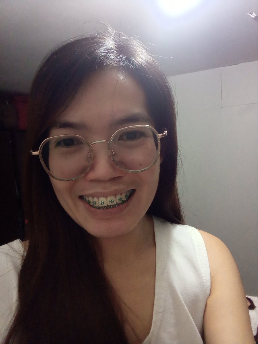 Rolieme22's tweet image. 85th day of braces 😁

#overbite