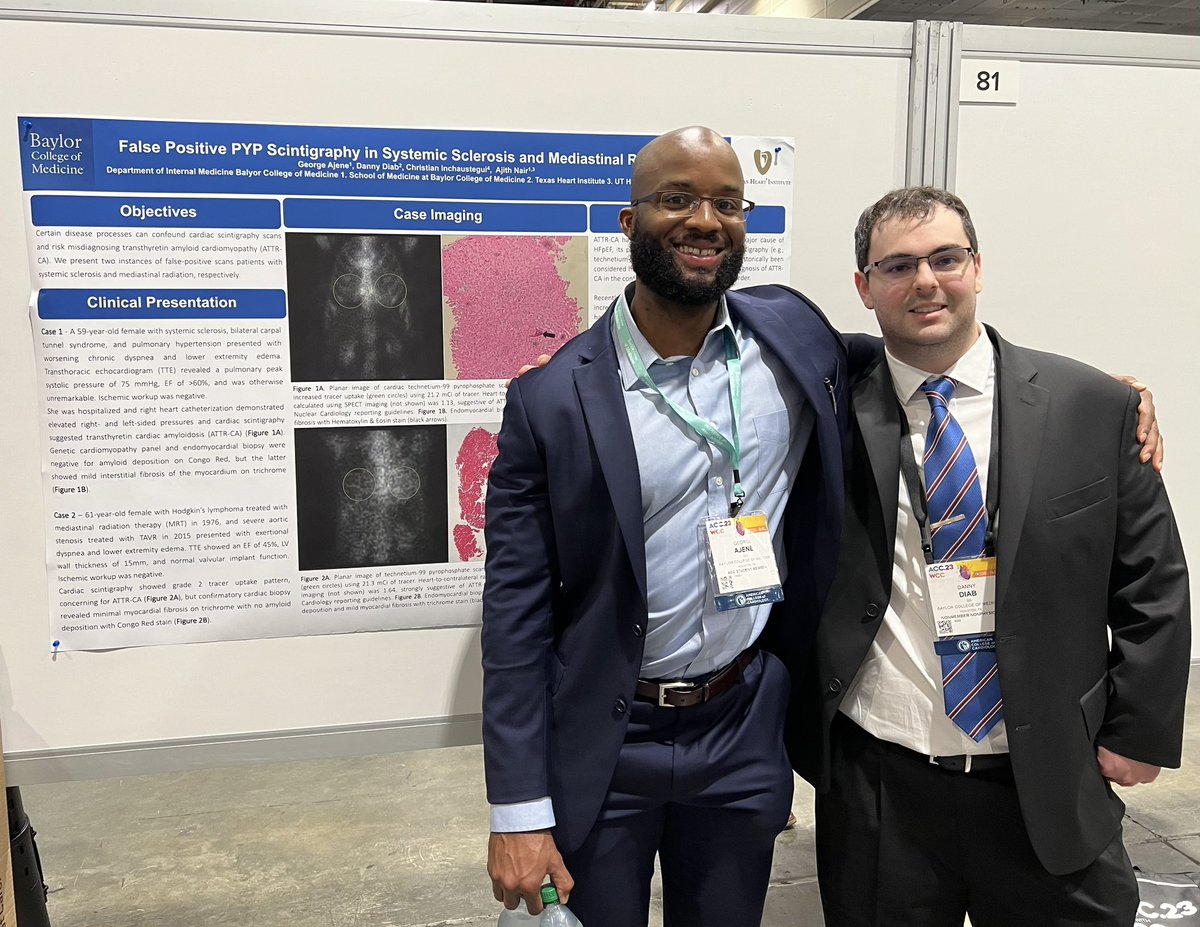 More exciting heart failure work from PGY2 @GeorgeAjene , MS3 Danny Diab, <a href="/InchausteguiC/">Christian Inchaustegui, MD</a>, <a href="/ajith1230/">Ajith Nair</a> , <a href="/JRH_MD/">Josh Hirsch, MD</a> - false +ve imaging tests for cardiac amyloid: systemic sclerosis, radiation, multiple myeloma! Bx still the gold standard! Kudos to great posters at #ACC23 <a href="/ACCinTouch/">American College of Cardiology</a>