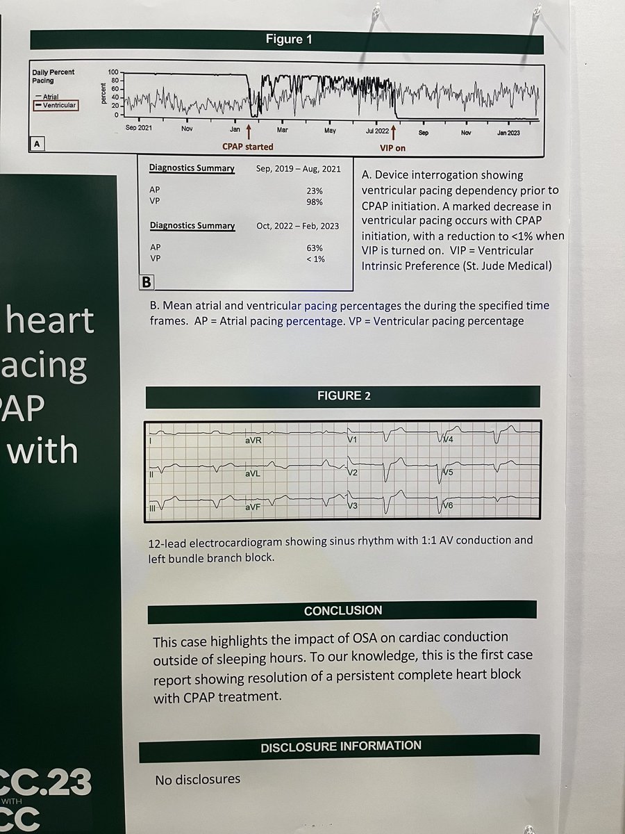 Great work by @UTHCardiology <a href="/UTHEPHEART/">UT EPHeart</a> EP #ACCFIT fellow Dr. Chris George presenting an unusual case of complete heart block and V-pacing dependency with initiation of CPAP for OSA. 
👉Highlights the importance of OSA screening in patients with bradyarrhythmias and AV block.