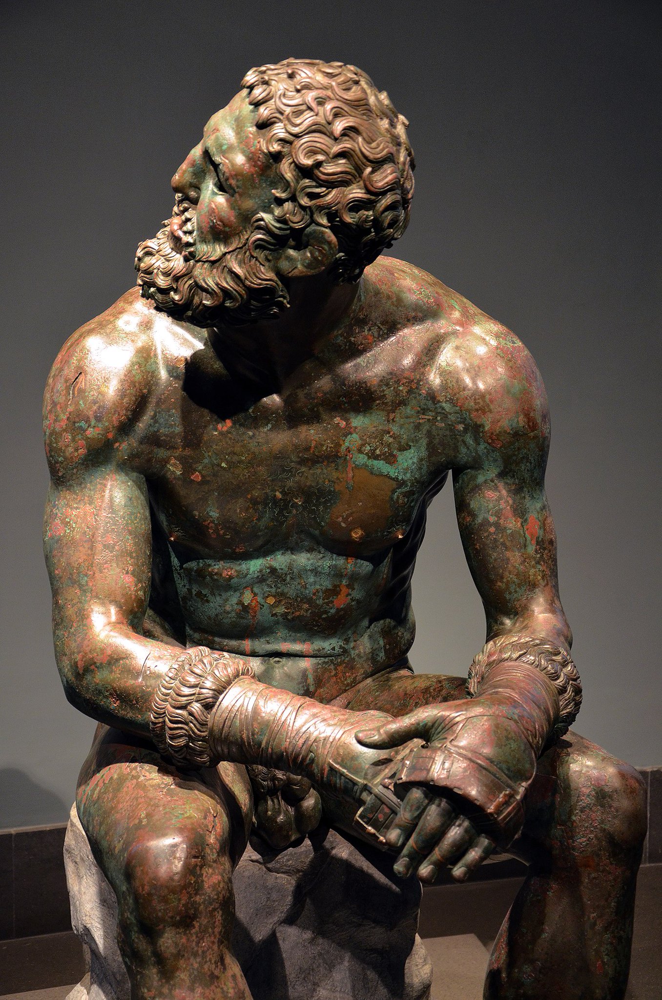 And Ancient Greek sculpture itself became more realistic during the Hellenistic Age. 

The Boxer at 