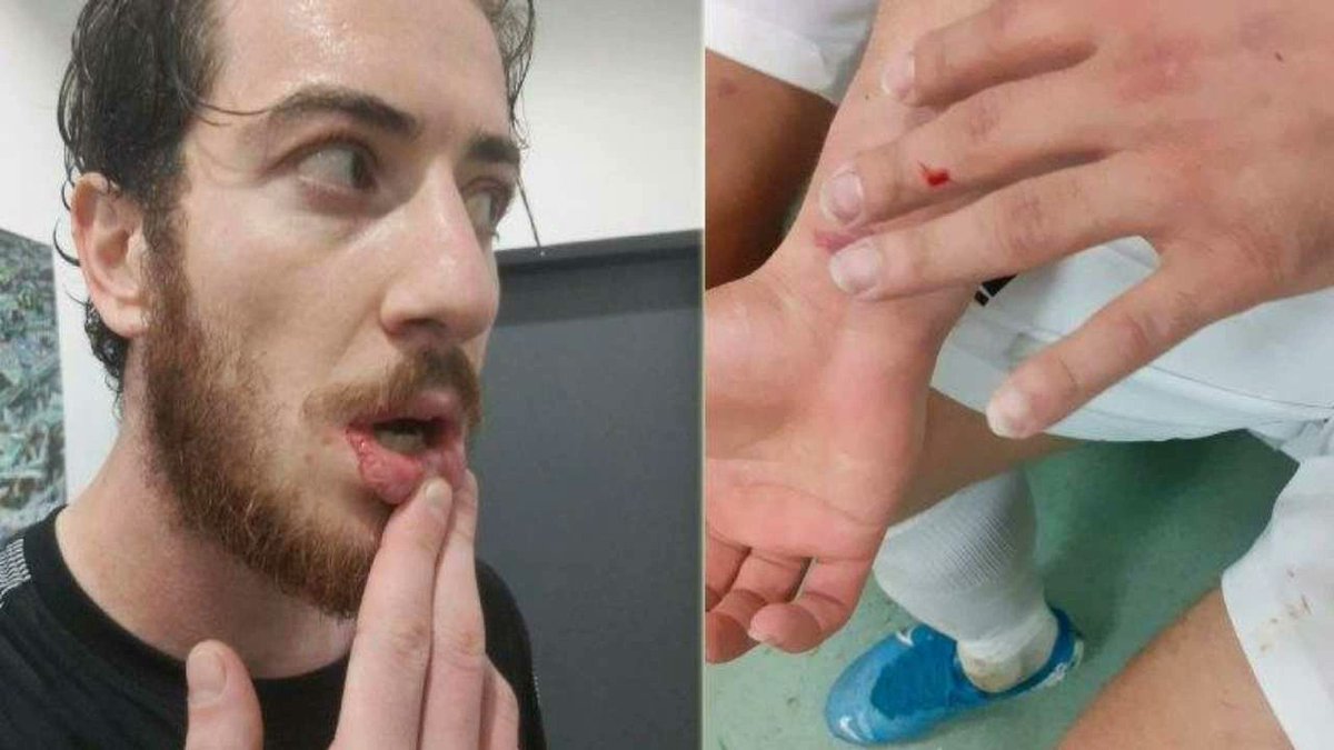 Amedspor kalecisi Cantuğ Temel:

"O kadar cisim atıldı ama beni en çok yaralayan, üzerinde bayrağımızın bulunduğu Türkiye haritalı cisim oldu. 

Milliyetçilik yapacağım derken ülkesinin değerlerinin yerlere fırlatılması, bir polis çocuğu olarak beni çok yaraladı."