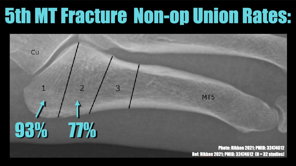 I'm struggling with a slide.  Can you help me with which one is more effective?  (Also, don't judge me for teaching non-POCUS stuff thaaaaaaanks)