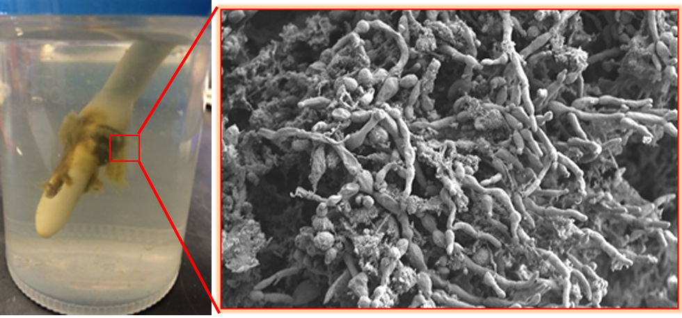 Finally, the 2nd most productive collaboration I have had with @alfmireles is out in <a href="/Scienceadvances/">Science Advances</a>. It started 7 years ago (even longer than our 1st most productive collaboration which is 6-years old!) when she collected patient's fungi-infected catheters. A little 🧵(1/7)