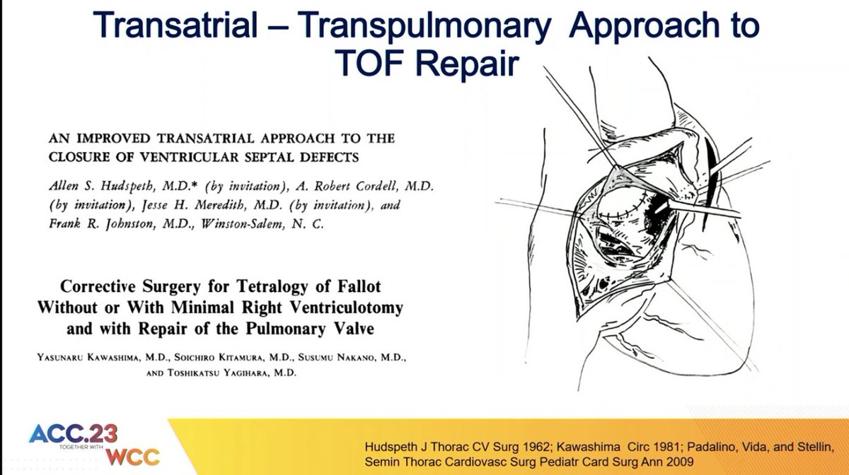 Starting #ACC23 session on assessment of VT risk in ToF. Dr. Anna Kamp leading off with a review of the history of ToF repair and how our understanding of VT risk in these individuals has evolved.