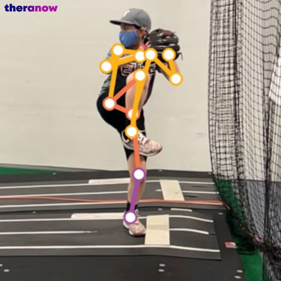 realtheranow's tweet image. Did you know that predictive technology is being used to prevent injuries in sports? #sportsafety #injuryprevention #predictivetechnology #sportsmedicine #athletictraining #healthtech #sportsperformance
