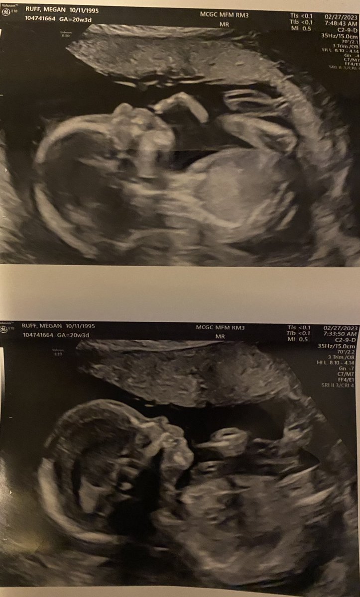 mwilson_ruff's tweet photo. baby girl we love you so much already 💖 https://t.co/lUBMyOviZj