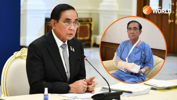 ASEANNOWTH's tweet photo. Thai PM’s condition improves after minor surgery on hand ➡️ https://t.co/OOmtk0fVGc
#ThaiPM #Surgery #Hand #ConditionImproves #HealthUpdate https://t.co/F77ANXodzQ