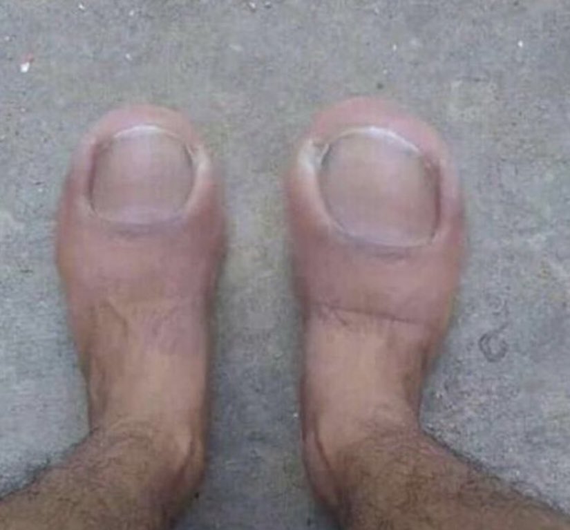 I see #toes is trending. Here’s mine lol 😂 open for DMs. Haha