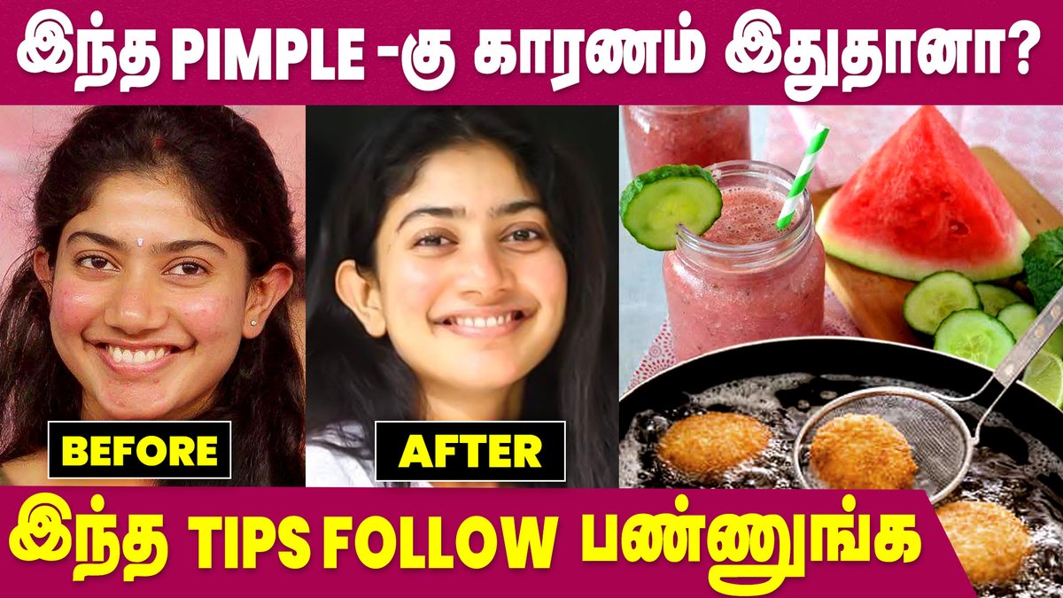 IbcMangai's tweet image. Causes of Pimples | Skin Care for Pimple-Prone Skin | Skin Care | IBC Mangai

WATCH NOW -- youtu.be/EAzrtH4u-40

#pimples #acne #pimplesremoval #skincare #pimplefreeskin #ibcmangai