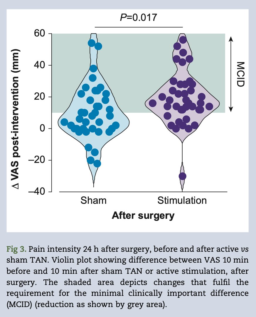 British Journal of Anaesthesia (@bjajournals) on Twitter photo Effect of transauricular nerve stimulation on perioperative pain. New single-blind, analyser-masked, randomised controlled trial by Patel et al #perioperative #pain #autonomic <a href="/_tomabbott/">Tom Abbott</a> <a href="/AcklandLab/">AcklandLab</a>
bjanaesthesia.org/article/S0007-… Effect of transauricular nerve stimulation on perioperative pain. New single-blind, analyser-masked, randomised controlled trial by Patel et al #perioperative #pain #autonomic <a href="/_tomabbott/">Tom Abbott</a> <a href="/AcklandLab/">AcklandLab</a>
bjanaesthesia.org/article/S0007-…