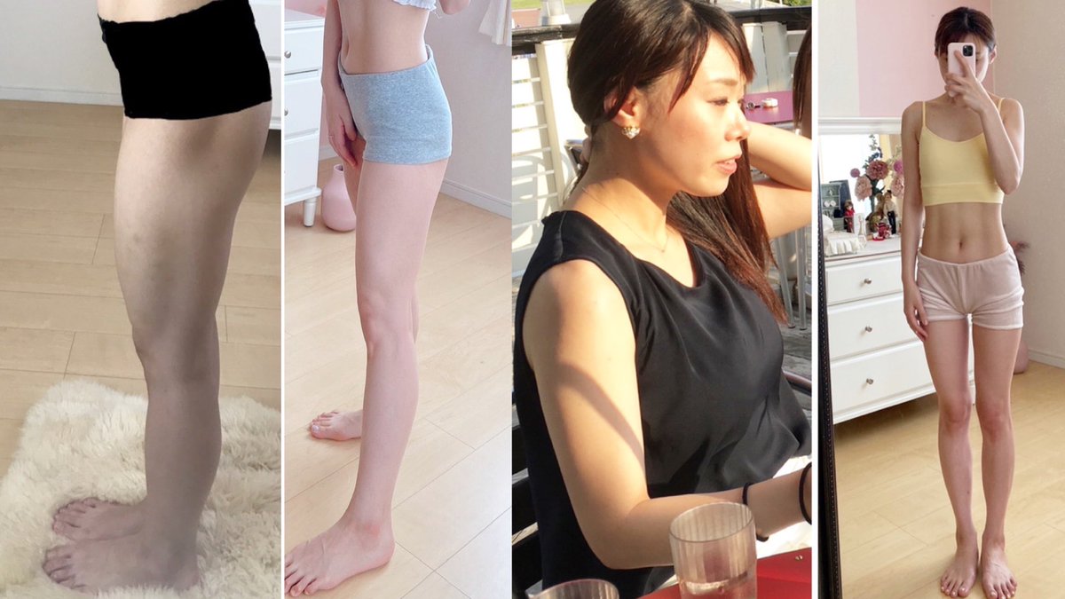 fukaiyuukii's tweet image. ガチで脚やせした方法を教わったから3種目だけシェア！『反り腰』『パツパツ前もも』『外もも張り』『裏もも お尻のセルライト』はもちろん「ぽっこりお腹」「ヒップアップ」にもオススメ！ベッドの上でも出来る！毎日必ずより、まず気が向いた時にやるくらいから初めてみて！30秒キツければ10秒でもOK