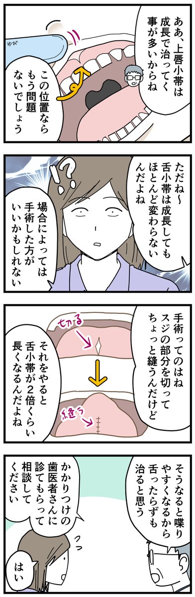 ナナオの3歳児健診6
上唇小帯っていうのは絵のとおり上の歯茎と唇をつなぐスジです。これが深いとすきっ歯になるため切除したりもするそうで、ナナオは1歳半健診で指摘されたのですが、もう大丈夫とのことでした。
#3歳 #育児漫画 