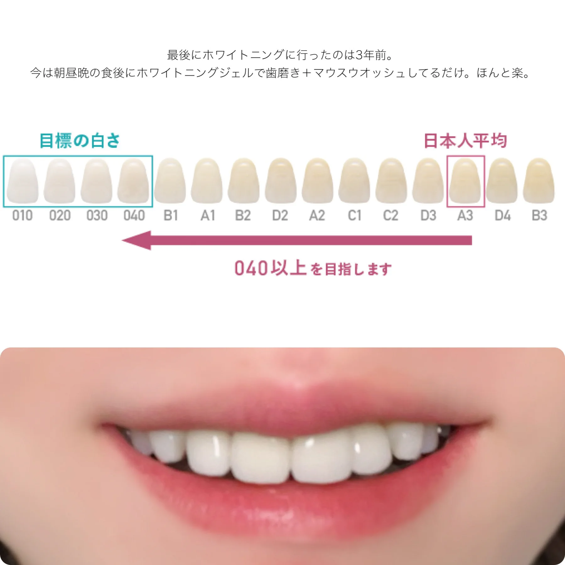 マスクが3月13日から解禁されるので・・口元ケア用品を試してきた私のおすすめ