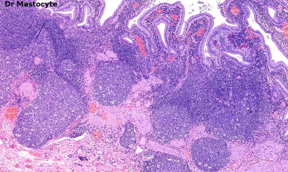 Dr Mastocyte tweet media