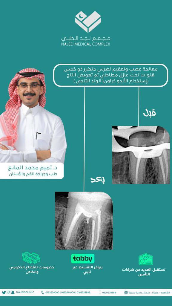 تسلم يدك دكتور تميم المانع  الشغل ولا غلطة ✅👏🏽

#مجمع_نجد #القصيم #عنيزة #نجد_الطبي
#مجمع_نجد_الطبي_في_عنيزة