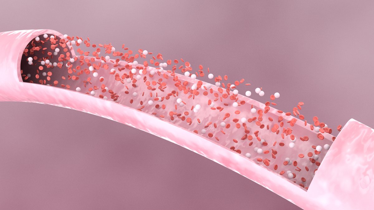 #urologie En relais des traitements de 1re intention, il est possible de réaliser des injections de plasma riche en plaquettes (PRP) pour traiter la #DysfonctionÉrectile chez certains patients 👉x9ix5.mjt.lu/lnk/AMYAAA8TwX…