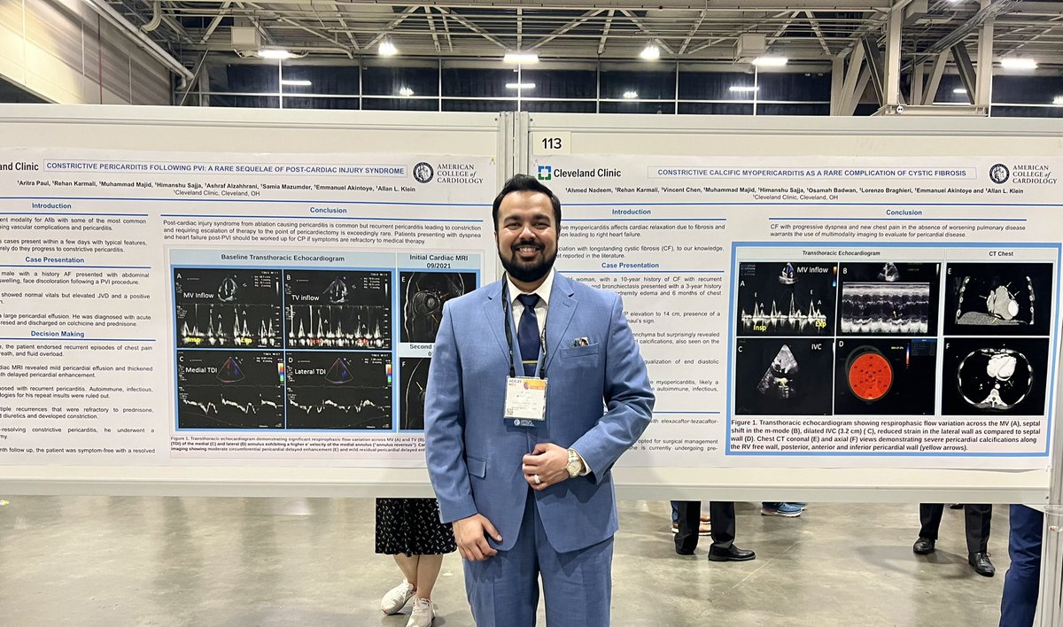 Rehan Karmali DO, MS (@rehankarmalido) on Twitter photo Finished up a thrilling weekend presenting two unique cases from the Pericardial Disease Center at <a href="/CleClinicHVTI/">Cleveland Clinic Heart, Vascular & Thoracic</a> ๐ซ #ACC23
<a href="/AllanLKleinMD1/">Allan L. Klein</a> <a href="/BadwanMD/">Osamah Badwan</a> <a href="/LorenzoBragh/">Lorenzo Braghieri, MD ๐ฎ๐น๐บ๐ธ๐ช๐บ</a> <a href="/DocMajid/">Muhammad Majid</a> <a href="/Mazumders_MD/">Samia Mazumder, MD</a> <a href="/CCF_IMCHIEFS/">Cleveland Clinic IM</a> Finished up a thrilling weekend presenting two unique cases from the Pericardial Disease Center at <a href="/CleClinicHVTI/">Cleveland Clinic Heart, Vascular & Thoracic</a> ๐ซ #ACC23
<a href="/AllanLKleinMD1/">Allan L. Klein</a> <a href="/BadwanMD/">Osamah Badwan</a> <a href="/LorenzoBragh/">Lorenzo Braghieri, MD ๐ฎ๐น๐บ๐ธ๐ช๐บ</a> <a href="/DocMajid/">Muhammad Majid</a> <a href="/Mazumders_MD/">Samia Mazumder, MD</a> <a href="/CCF_IMCHIEFS/">Cleveland Clinic IM</a>