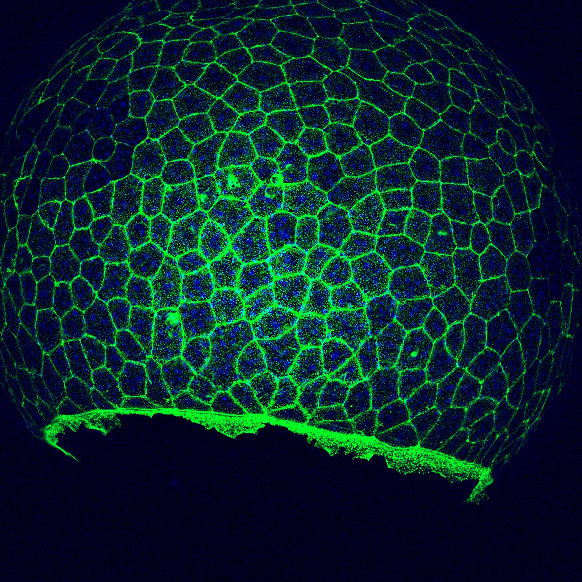ZebrafishRock's tweet photo. Our #SpotlightZebrafish this week is on Bakary Samasa (@SamasaBakary), a grad student w/ @MaryC_Mullins @PennCDB. His project is focused on elucidating the mechanisms of epiboly, specifically relating to how the cytoskeleton and calcium interplay to drive this complex process 1/2 https://t.co/jkipHqAvOf