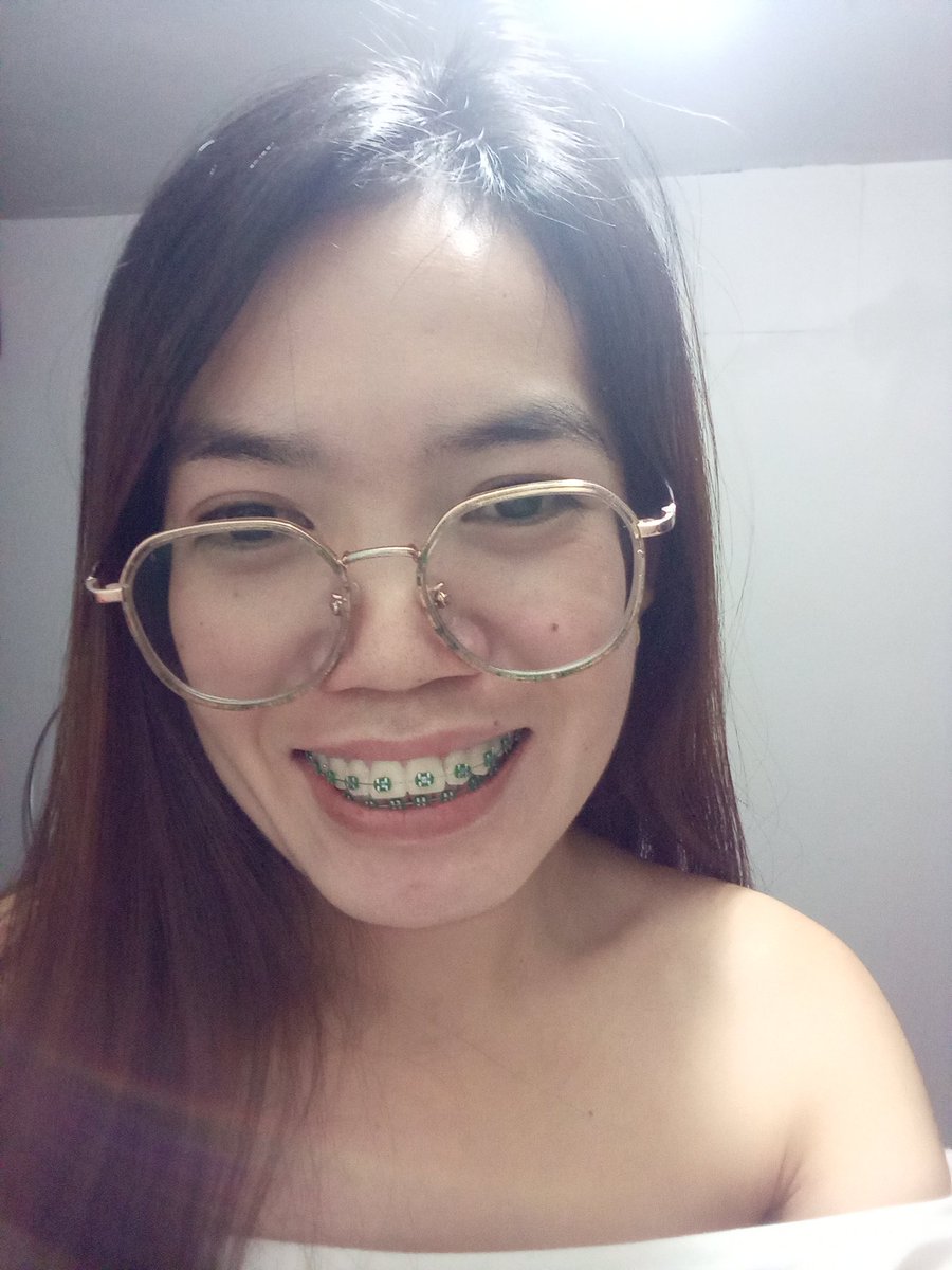 Rolieme22's tweet image. 86th day of braces 😁

#overbite