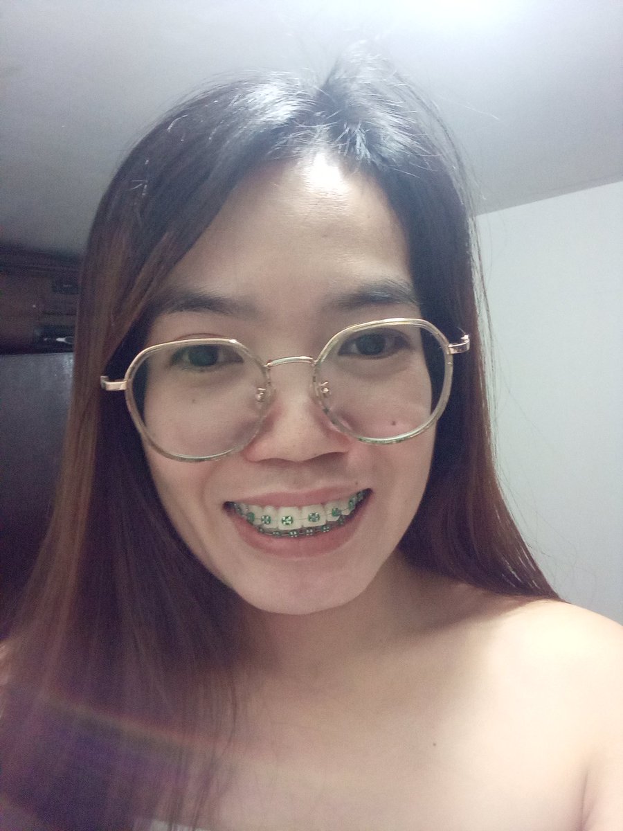 Rolieme22's tweet image. 86th day of braces 😁

#overbite