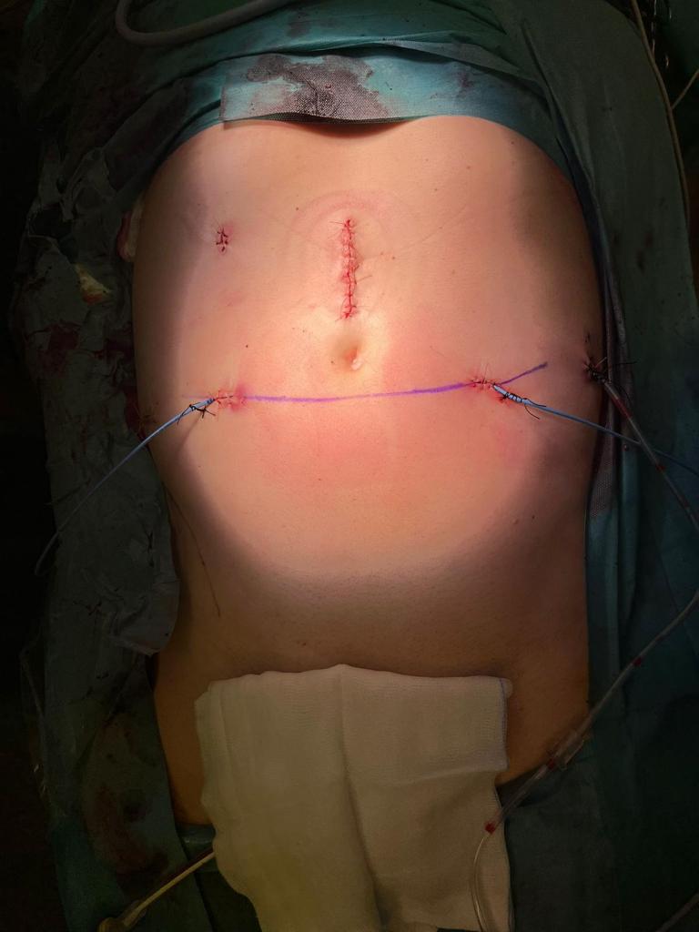 Luca Sarchi tweet media