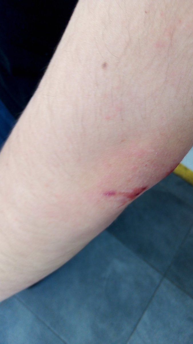 Bassad_'s tweet photo. @Emikukis me declaro ahora fiel fan tuyo, también sufrí un accidente de moto. 👍 https://t.co/VvImiPzmrJ