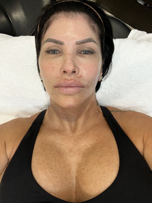 Bout to get my stomach neck and face blasted w needles. It&rsquo;s going to hurt like Fukkkkkk. But beauty<a href="/tag/keepingittight"class="tags"><span>#keepingittight</span></a><a href="/tag/keepingitright"class="tags"><span>#keepingitright</span></a><a href="/tag/16needles"class="tags"><span>#16needles</span></a><a href="/tag/m"class="tags"><span>#m</span></a>