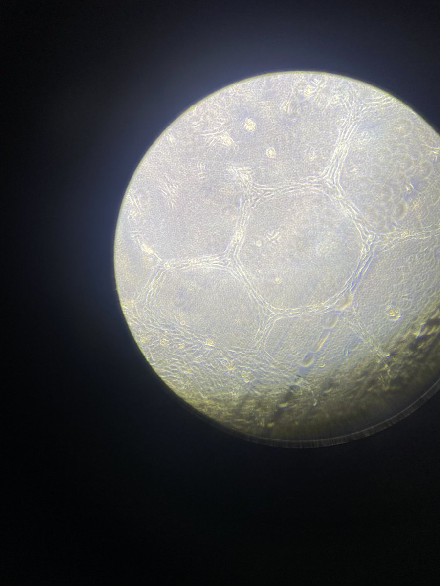 ‘Patterns on the moon’

Or fibroblasts from the lymph node grown in a biologically relevant topology!

#science #PhD #biology #UCL