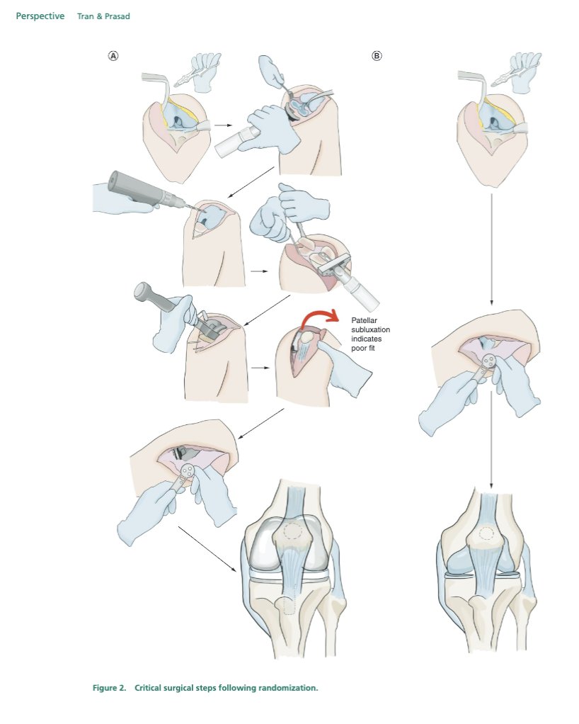 OUT Now! Our paper providing a visual surgical atlas for a proposed, Randomized, SHAM controlled trial of Total Knee Arthoplasty TKA This is the 7th paper @audreyamadean did with me in her year off at OHSU & she illustrated it! Check it out 👇 🧵 becarispublishing.com/doi/full/10.57…