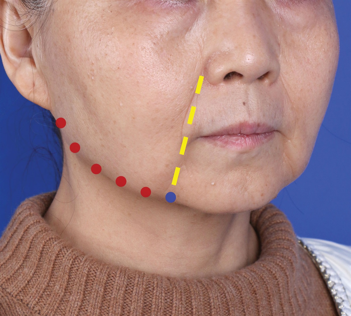 Plastic and Reconstructive Surgery tweet media