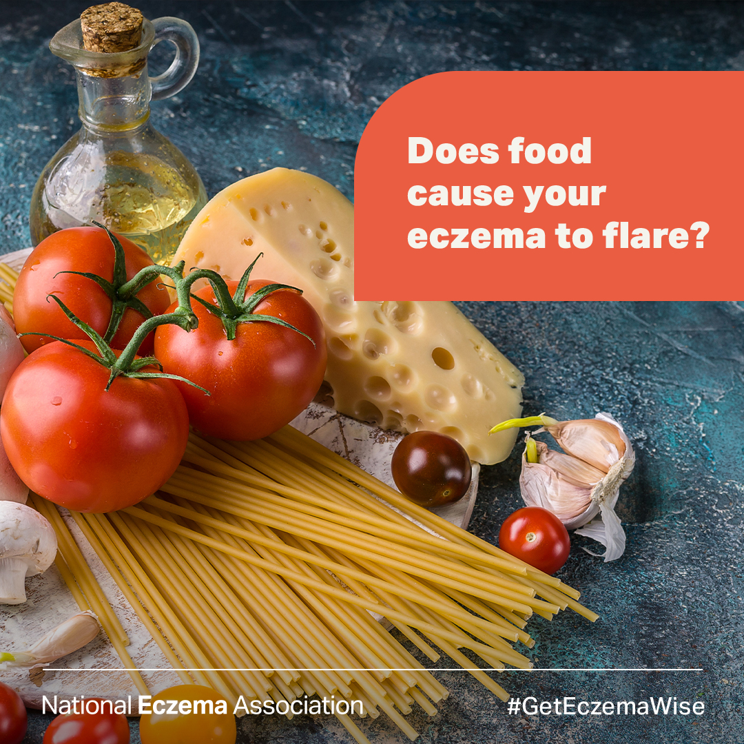 National Eczema on Twitter "On this episode of NEA's podcast, Eczema