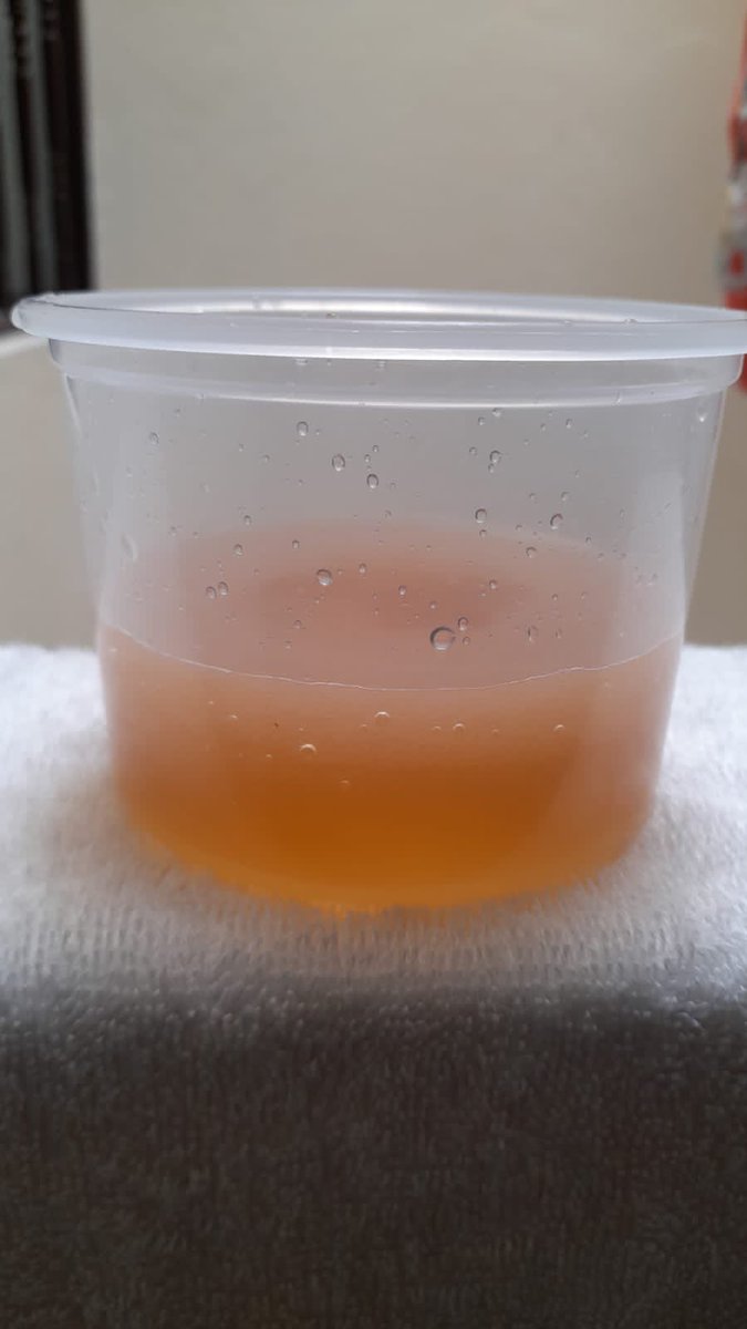 crstntrjs's tweet photo. @AcueductoBogota @Superservicios @SectorSalud señores el agua de la localidad de usme nos está perjudicando a todos, tengo un niño de un año y medio de edad y tuvo una gastroenteritis, se tuvo que medicar a cuestión de la mala calidad del agua. Quien escucha a los habitantes ? https://t.co/RgYtvKDdMD