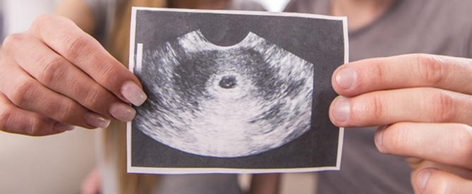 0e_se's tweet photo. new child announcement: it's veranda https://t.co/fsuq8y0Ce6